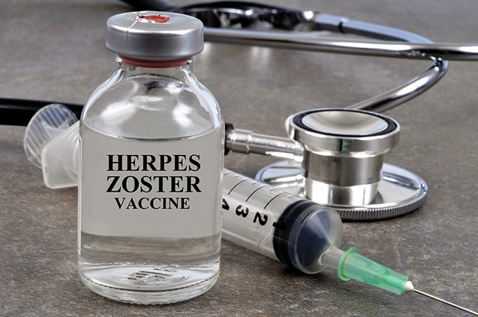 How Serious Is Herpes Zoster Ophthalmicus? Eye Shingles Symptoms, Causes, Contagion Risks, and Prevention Methods